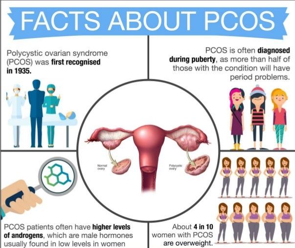 Co je to PCOS? 